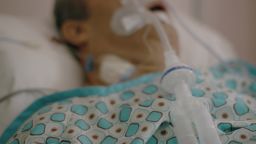 Экспериментальная стимуляция мозга может помочь отключить «пожарную сигнализацию» хронической боли