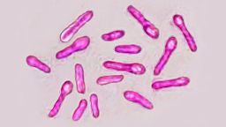 FDA предупреждает сайты, продающие несертифицированный ботокс для косметических целей FDA предупреждает сайты, продающие несертифицированный ботокс для косметических целей