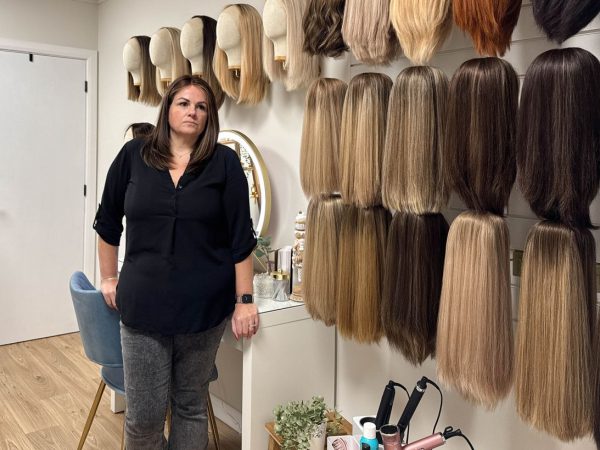 Пересадка волос у женщин процветает. Успех операции сложен.