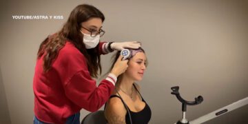 Пересадка волос у женщин процветает. Успех операции сложен.