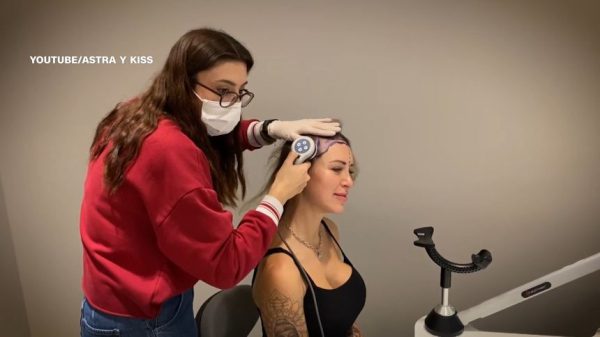 Пересадка волос у женщин процветает. Успех операции сложен.