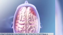 Исследование показало, что скрытые генетические повреждения также являются частью ХТЭ.