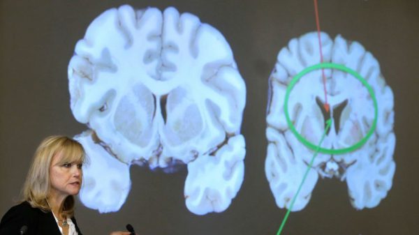 Исследование показало, что скрытые генетические повреждения также являются частью ХТЭ.