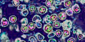 В Сиднее, вероятно, циркулирует крайне инфекционное, смертельно опасное заболевание