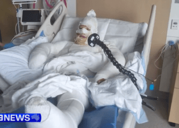 «Как будто поджарилась»: мать из Западной Австралии получила серьёзные ожоги в результате бомбардировки зажигательными бомбами