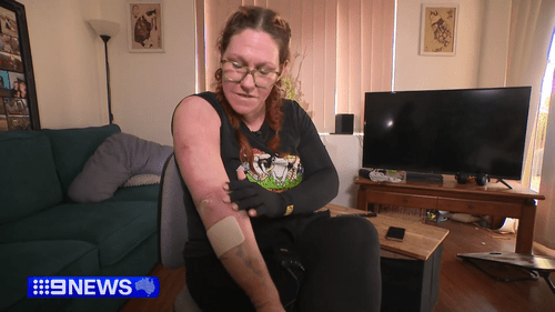 «Как будто поджарилась»: мать из Западной Австралии получила серьёзные ожоги в результате бомбардировки зажигательными бомбами