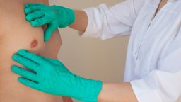 Новое исследование показывает, что пропуск первой маммографии связан с повышенным риском смерти от рака груди