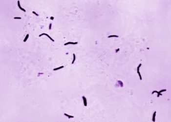 Крушение турецкого военного самолета в Грузии: погибли все 20 человек на борту Крушение турецкого военного самолета в Грузии: погибли все 20 человек на борту