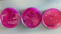 Вспышка сальмонеллёза в нескольких штатах может быть связана с устрицами. Что следует знать людям.