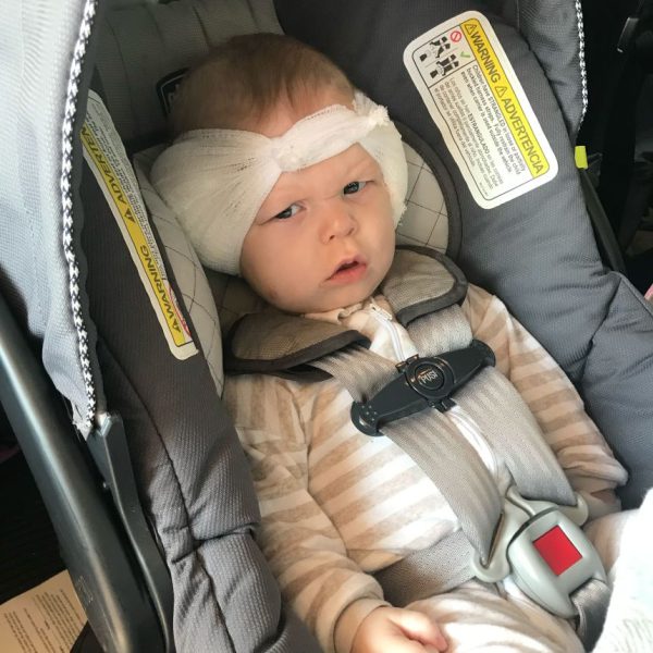 Дети в возрасте от 7 месяцев теперь имеют доступ к «трансформирующим» кохлеарным имплантатам