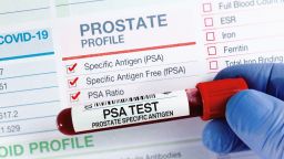 Может ли езда на велосипеде разрушить вашу сексуальную жизнь? Мнение уролога.