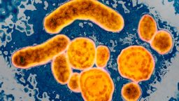 Советники CDC откладывают решающее голосование по вакцинации против гепатита B на напряженной встрече