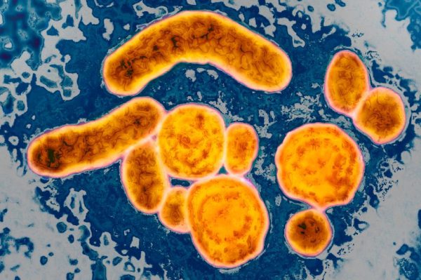 Консультанты Центра по контролю и профилактике заболеваний (CDC) голосуют против всеобщей вакцинации детей от гепатита В. По словам критиков, это «усугубляет заболевание Америки».