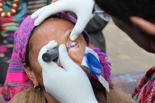 Из Непала в мир: его наследие – это не только возвращение зрения; это целая армия врачей, которых он обучил.