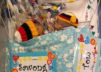 Один из сиамских близнецов, доставленных из Папуа — Новой Гвинеи, умер после экстренной операции в Сиднее.