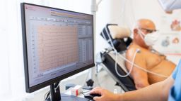 Новое исследование показывает, что вакцина против опоясывающего лишая может замедлить прогрессирование деменции