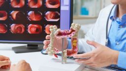 Среди молодых людей снижается смертность от основных причин смерти от рака, за исключением колоректального рака.