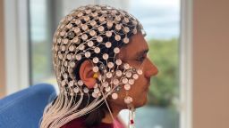 Первыми на CNN сообщили: неинвазивные методы лечения депрессии с помощью воздействия на мозг оказались эффективными.