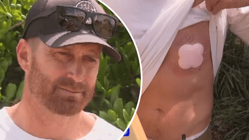 12-летний Нико Антич, пострадавший от нападения акулы, скончался в больнице.