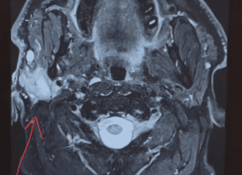Макс и Дункан продали всё, чтобы стать кочевниками. Затем им поставили мрачный диагноз.