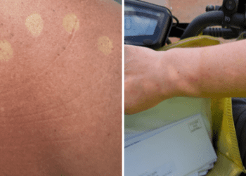 Почтальонам приказали прекратить носить униформу на фоне сообщений о солнечных ожогах.