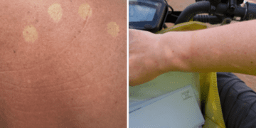 Почтальонам приказали прекратить носить униформу на фоне сообщений о солнечных ожогах.