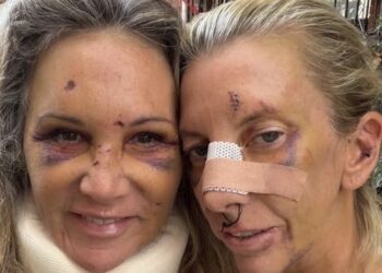 Отважные женщины из Сиднея, подвергшиеся жестокому нападению со стороны стоматолога, поделились фотографией, сделанной во время их выздоровления.