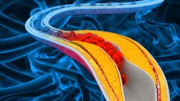 Ещё миллионы людей могут нуждаться в начале приёма препаратов, снижающих уровень холестерина, уже в возрасте 30 лет. Вот почему.