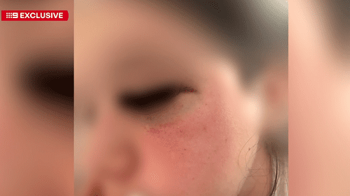 Мать требует возбуждения уголовного дела после предполагаемого нападения на 12-летнюю девочку после школы. Мать требует возбуждения уголовного дела после предполагаемого нападения на 12-летнюю девочку после школы.