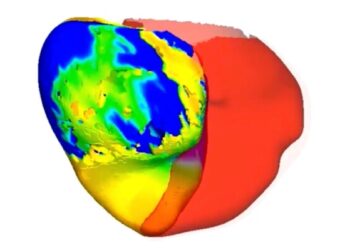 Нападения на Иран и другие страны Ближнего Востока продолжаются, а Трамп угрожает эскалацией.