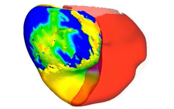 Нападения на Иран и другие страны Ближнего Востока продолжаются, а Трамп угрожает эскалацией.