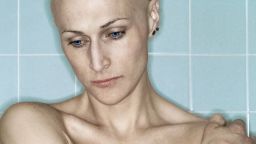 Эти женщины удалили себе грудь, чтобы предотвратить развитие рака. А потом пришла боль. Эти женщины удалили себе грудь, чтобы предотвратить развитие рака. А потом пришла боль.