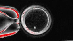 В 2025 году уровень рождаемости в США снова упал до рекордно низкого уровня.