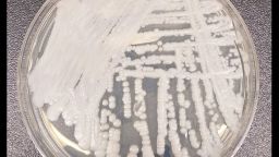 Что нужно знать о Candida auris, грибке, поражающем медицинские учреждения.