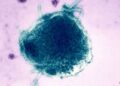 Центр по контролю и профилактике заболеваний (CDC) не учитывает 2 случая смерти от кори в Пенсильвании, что обостряет межпартийный конфликт.